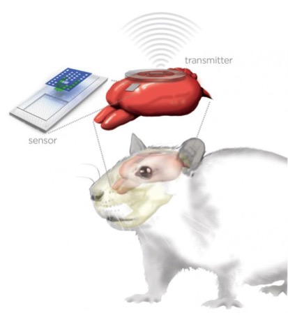 Tiny brain sensors